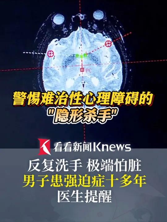 肮脏的心理,数据整合方案实施_投资版121，127.13