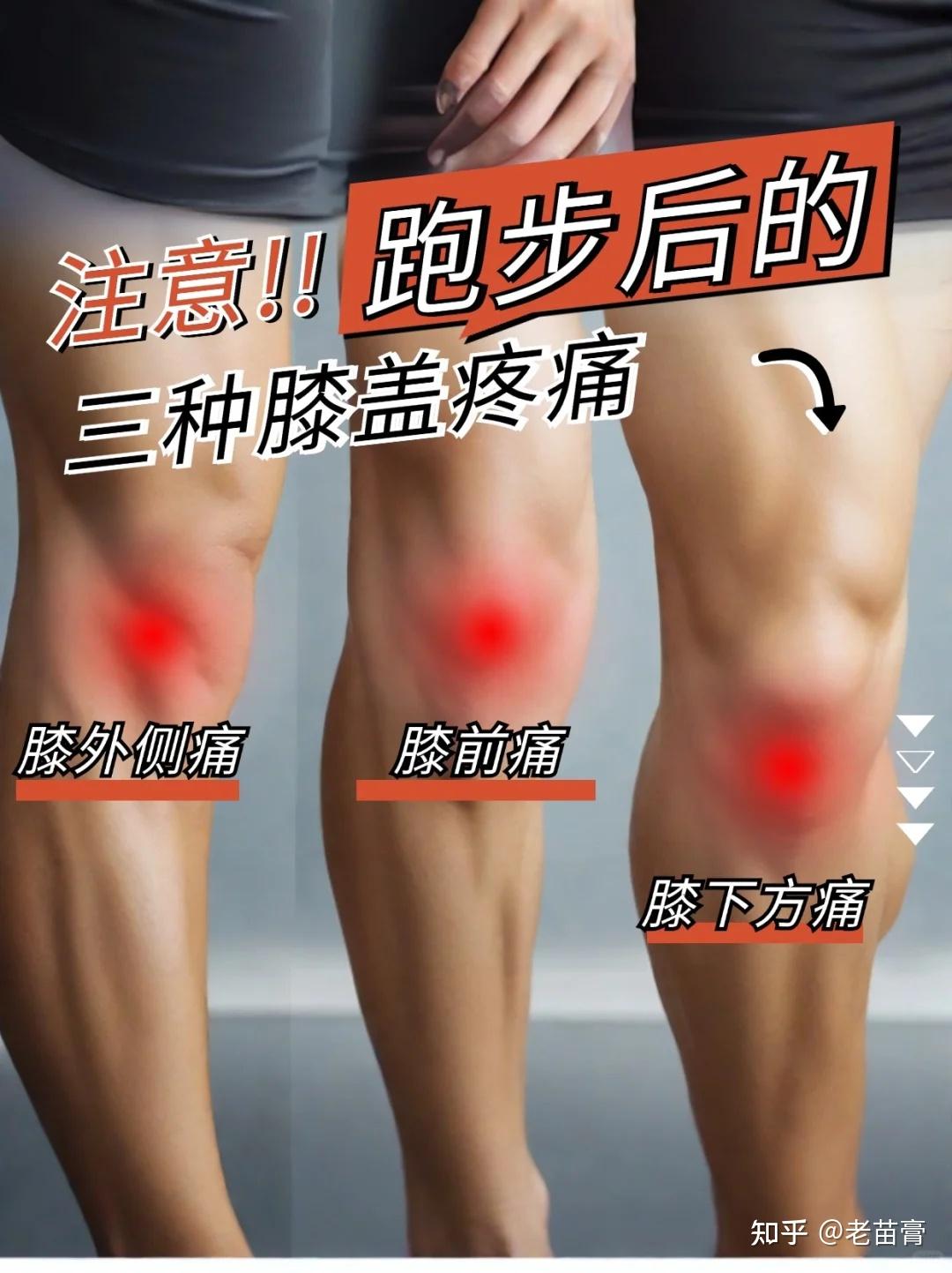 练体育膝盖疼怎么治,豪华精英版79.26.45-江GO121，127.13