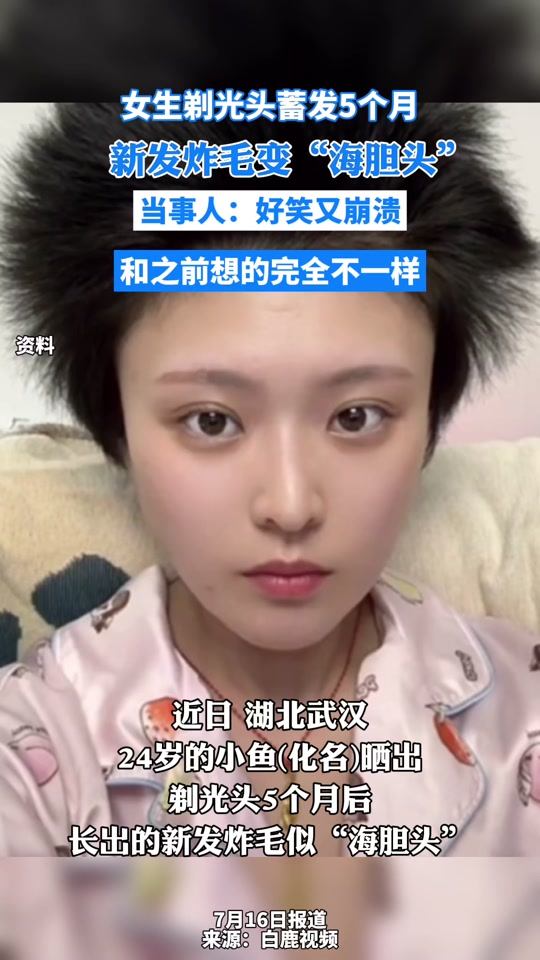 女生剃光头蓄发5个月炸毛似海胆,效能解答解释落实_游戏版121，127.12